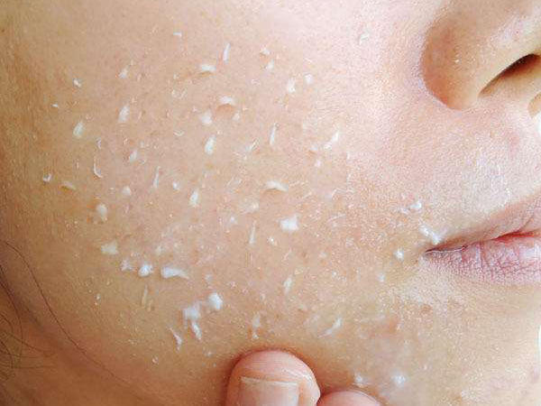 毛孔粗大做深层清洁能改善吗,毛孔粗大深层清洁用什么牌子面膜