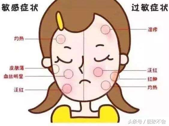 化妆品过敏皮炎反复复发怎么治愈,化妆品过敏应该吃什么药