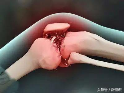 骨刺是越磨损长得越快吗,骨刺一般多久才会消