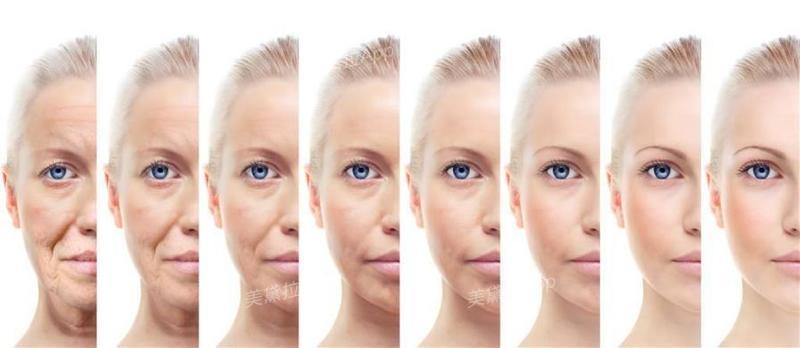 菲洛嘉水光和菲洛嘉营养水光区别,菲洛嘉水光网红