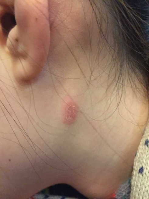 武汉联合宠物医院汉口好吗,我感染了猫癣会传染给老公吗