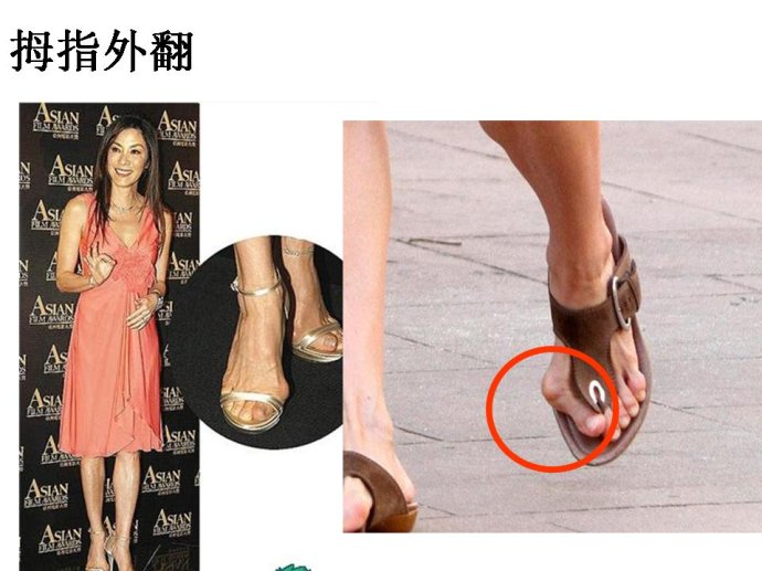 杨丞琳用黑绷带,杨丞琳安慰粉丝视频