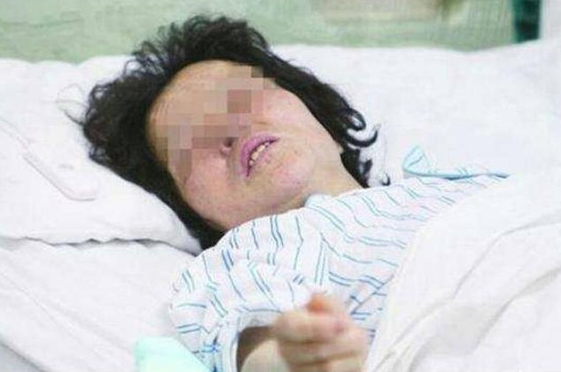 生完孩子1个月子宫前壁下垂,宝妈坐月子这样折腾出大问题了吧