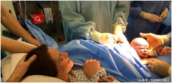 二次剖宫产宫缩痛多久,如果第一胎是剖第二胎顺产会快吗