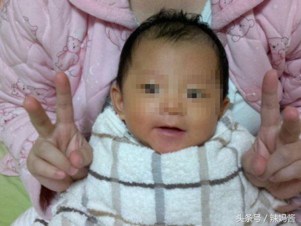 新生儿黄疸22.5有可能是脑瘫吗,小孩出生40天黄疸一直未退