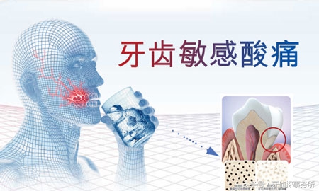 牙齿敏感抗敏牙膏有效吗,牙齿冷热酸甜都敏感用哪种牙膏