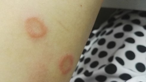 武汉联合宠物医院汉口好吗,我感染了猫癣会传染给老公吗