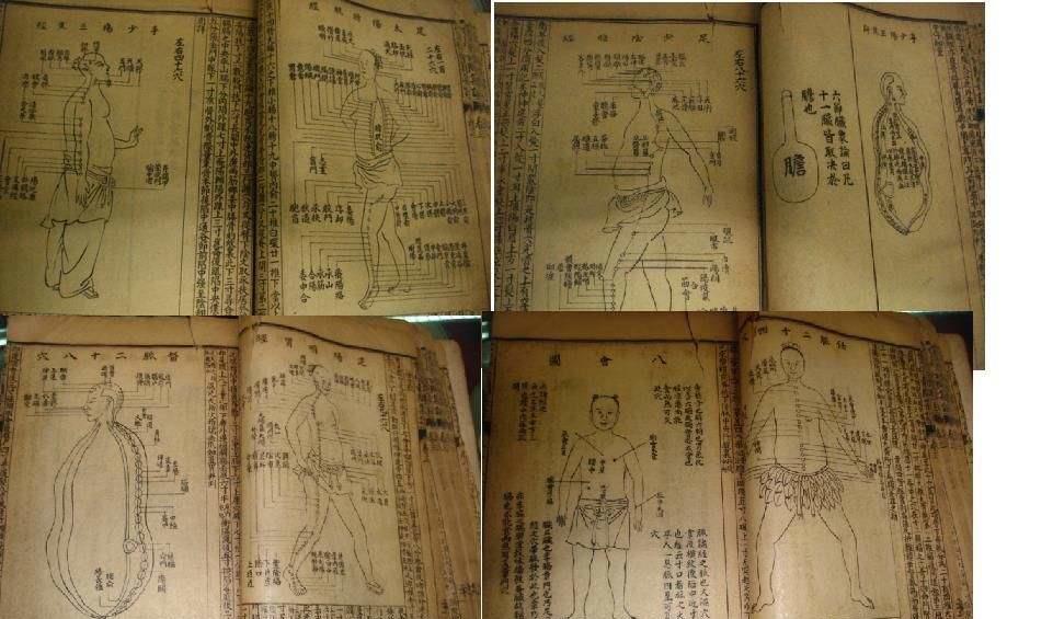 颈椎病的常见分型有哪些,颈椎病常见的分型有哪些