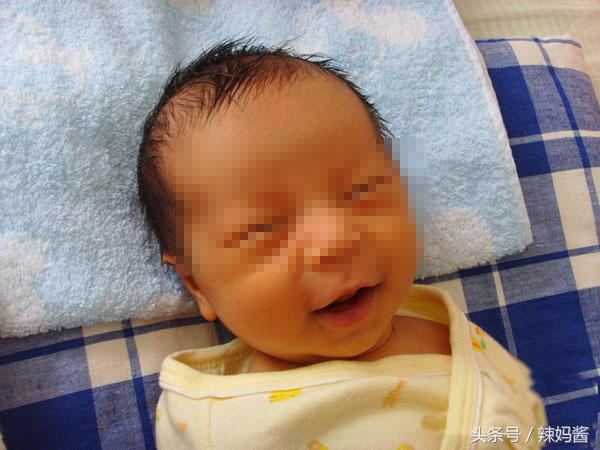 新生儿黄疸22.5有可能是脑瘫吗,小孩出生40天黄疸一直未退