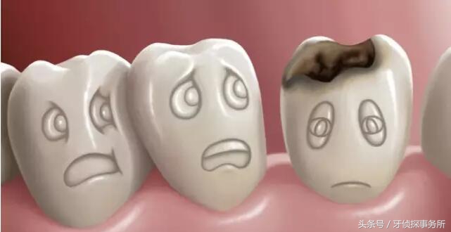 牙齿敏感抗敏牙膏有效吗,牙齿冷热酸甜都敏感用哪种牙膏