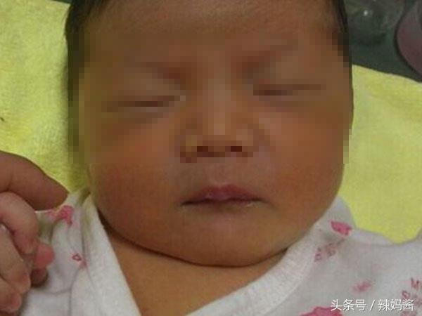 新生儿黄疸22.5有可能是脑瘫吗,小孩出生40天黄疸一直未退