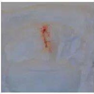 出生七天的宝宝尿布上有血,刚出生的婴儿尿布上有血迹