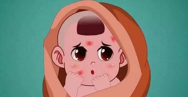 胎记治疗无效果,胎记治疗切勿操之过急