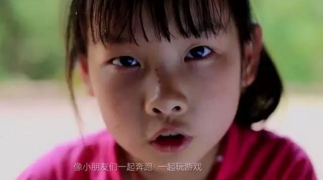 胎记治疗无效果,胎记治疗切勿操之过急