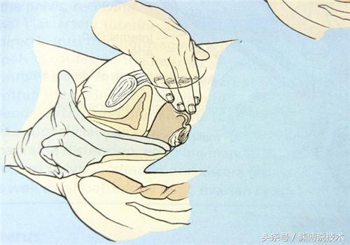 顺产开十指是十根手指宽吗,顺产开十指是多少