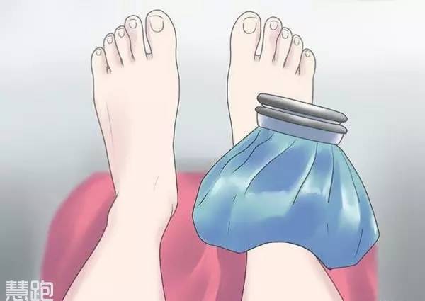 90%的跑友受伤后都用错了外敷药物