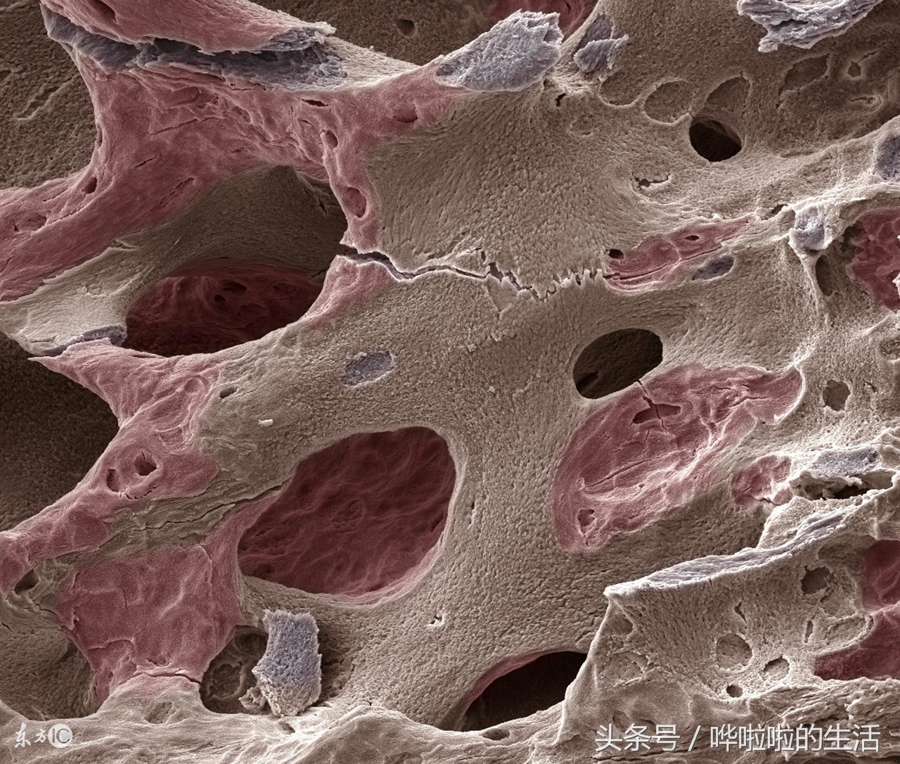 补钙过量过几天恢复正常钙量,过量补钙对身体有什么危害