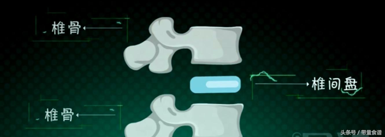 坐不久站不久用什么治疗,刚刚腰椎间盘突出怎么办