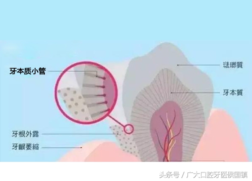 牙槽骨萎缩是什么症状,牙齿出现牙龈萎缩怎么办