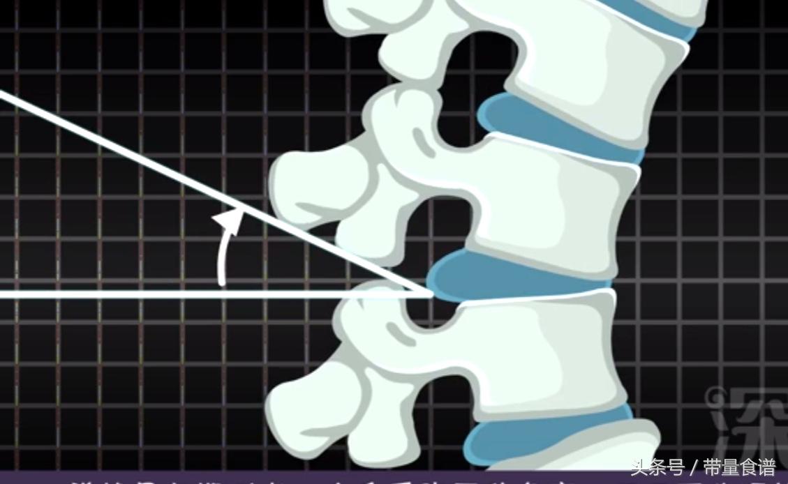 坐不久站不久用什么治疗,刚刚腰椎间盘突出怎么办