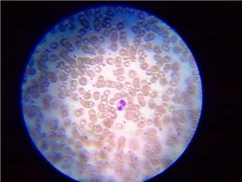 六种策略教你摆脱孕期泌尿系感染！