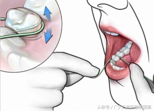 牙槽骨萎缩是什么症状,牙齿出现牙龈萎缩怎么办