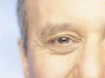 网红眼药水真有那么好吗,这些网红眼药水暗藏风险