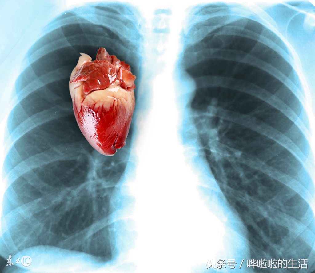 补钙过量过几天恢复正常钙量,过量补钙对身体有什么危害