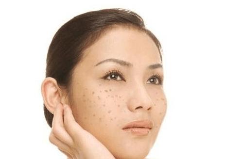 如何淡化色斑祛黑色素,怎么淡化色斑小方法视频