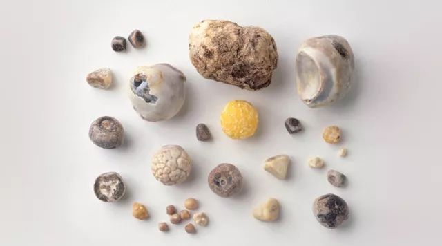 肚子疼和脾胃功能有关系么,肚子疼跟肠胃有关系吗