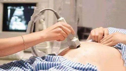 怀孕后这些检查千万不能遗漏产房人员的建议