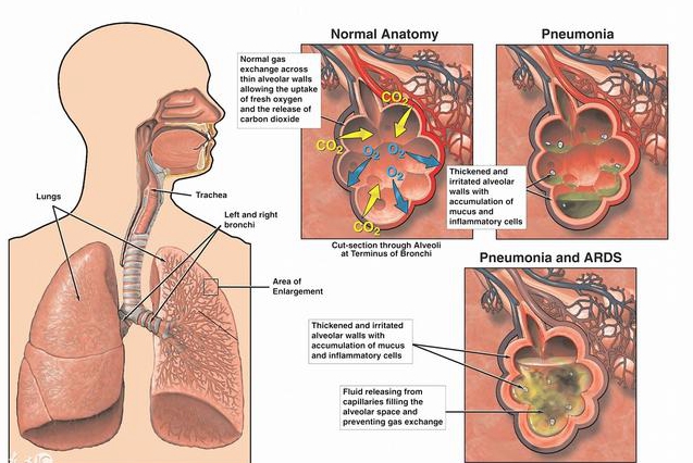 中医治老慢支用什么药,治疗老慢支的茶饮