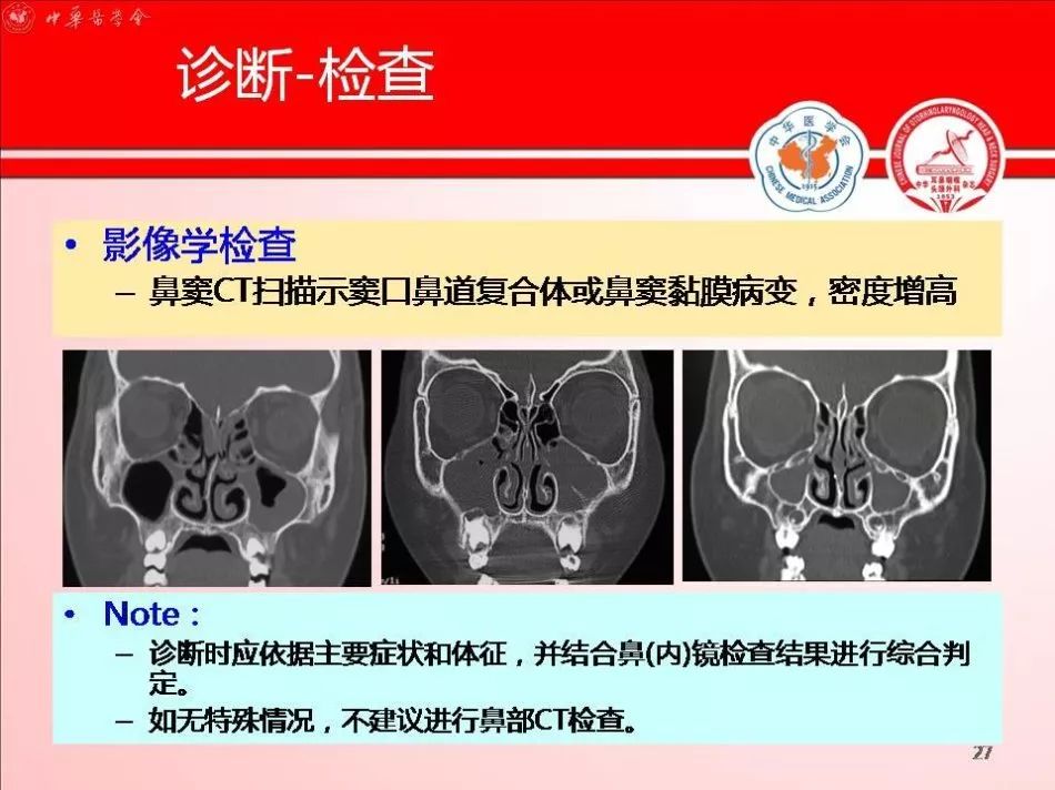 孩子感冒一个星期了还流清涕,孩子鼻窦炎咳脓痰流脓鼻涕