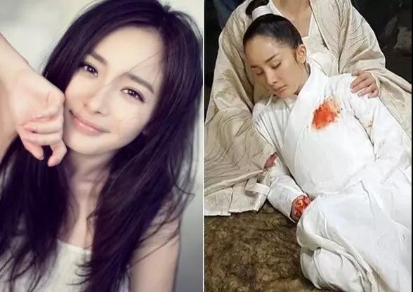 一招解决你的脱发秃顶,轻松告别脱发挽救你的发际线