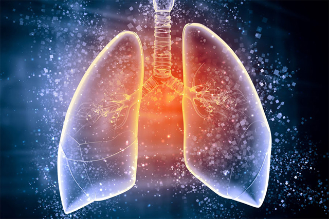 非小细胞腺癌：最常见的肺癌类型