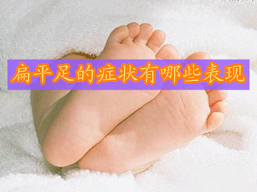 了解扁平足的症状利于更好的治疗
