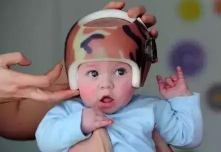 宝宝头型不正,宝宝扁头怎么纠正头型