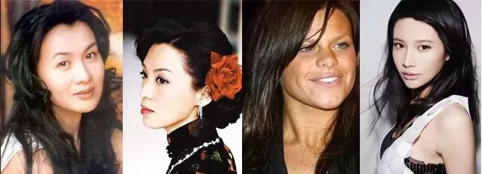 ”红颜杀手”——宫颈癌发病趋向年轻化！