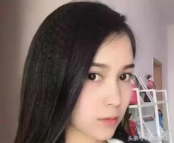 敷麻药过敏红疹一般多久自愈,麻药不敏感怎么办