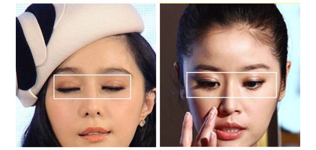 肿眼泡双眼皮贴正确的贴法,蕾丝双眼皮贴正确的贴法