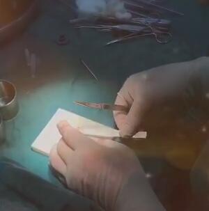 鼻综合隆鼻用什么材料,耳软骨和肋骨隆鼻费用多少钱