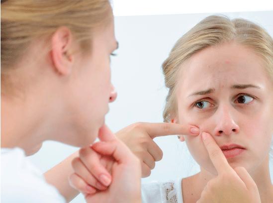 脸上长痘痘怎么办青春期学生,脸上长痘痘怎么办用什么护肤品