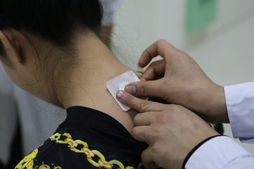 你还为脸上雀斑烦恼吗,你还为红斑狼疮所困扰吗