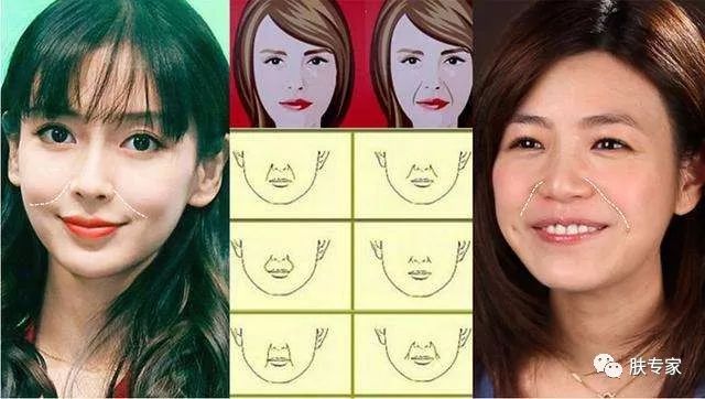 法令纹可以通过护肤品改善吗,有护肤手法真的能淡化法令纹吗