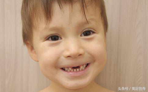 乳牙和恒牙并立时需要拔掉乳牙吗,儿童乳牙都会换掉吗