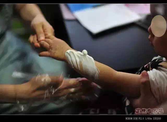 如何预防新生儿得湿疹,新生儿怎么避免得湿疹