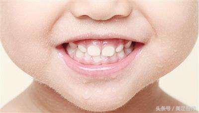 乳牙和恒牙并立时需要拔掉乳牙吗,儿童乳牙都会换掉吗