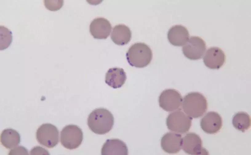 穿好奶奶织的毛裤,你依旧无法避免与风湿膏药共度晚年