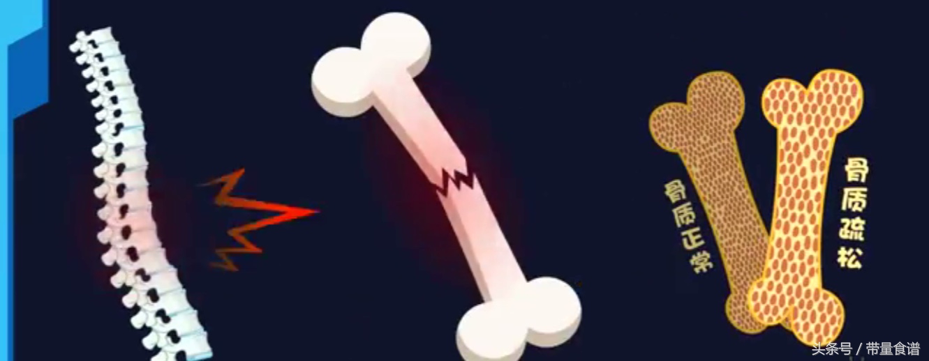 更年期会导致肿瘤高发,心梗脑梗!如何安全度过更年期?