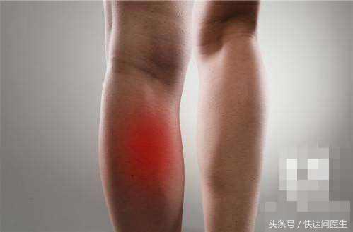 下肢动脉血栓的症状与危害,下肢动脉血栓能治好吗